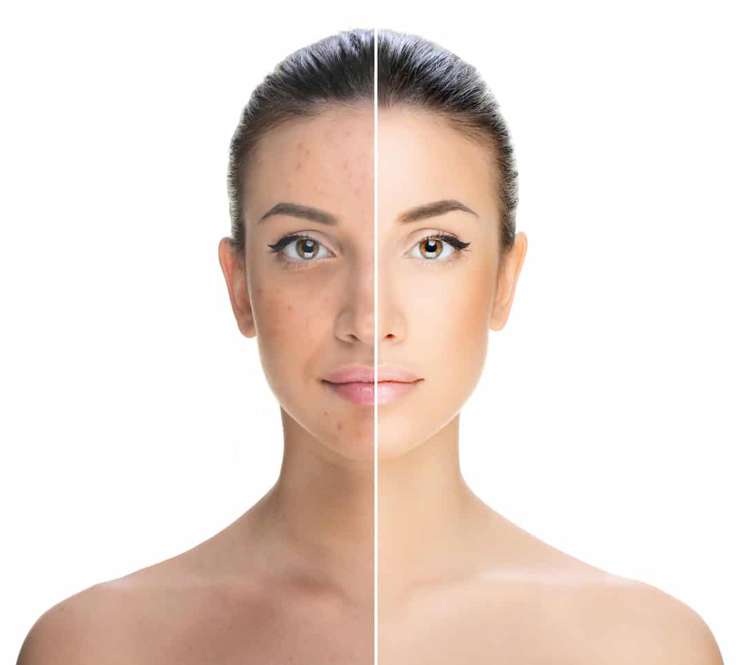 The SaltFacial